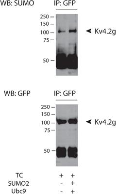 SUMOylation of the Kv4.2 Ternary Complex Increases Surface Expression and Current Amplitude by Reducing Internalization in HEK 293 Cells